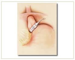 Slider image (2) Panama Gastric Surgery Center